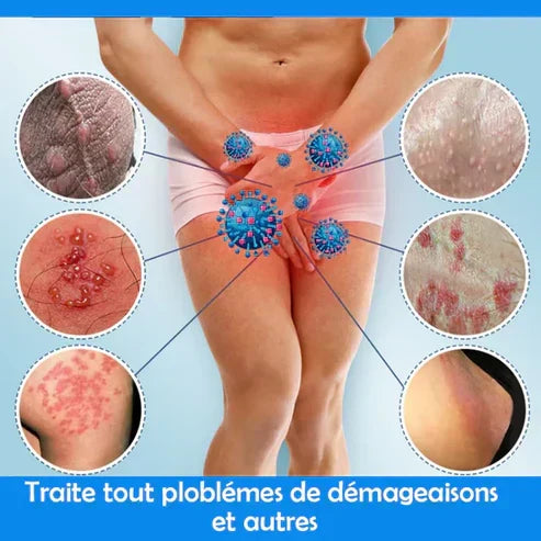Solution aux infections et démangeaisons intimes GB